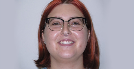 Smiling woman before dental treatment