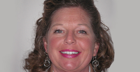 Woman smiling after dental work