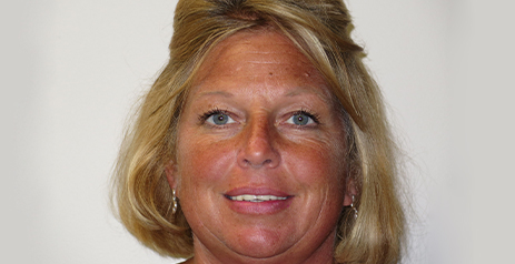 Woman smiling before dental work