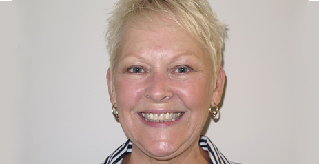 Woman smiling before dental treatment