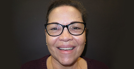 Woman grinning after dental treatment