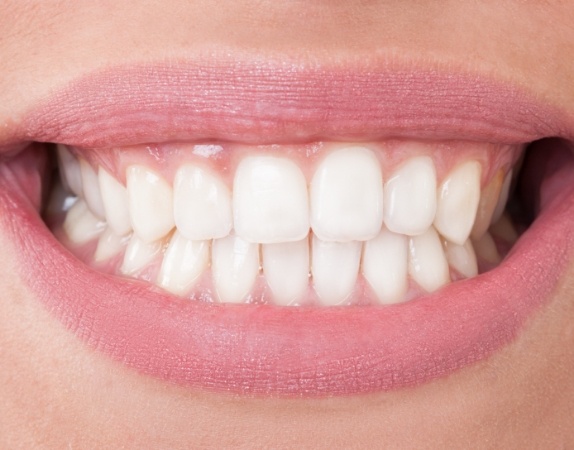 Close up of a person with straight white teeth smiling