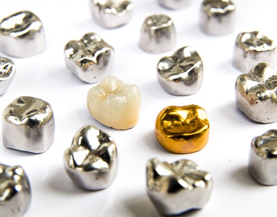 Various types of dental crowns on a table