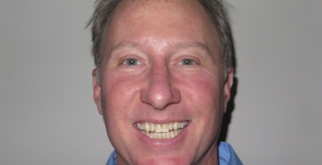 Man smiling after Invisalign