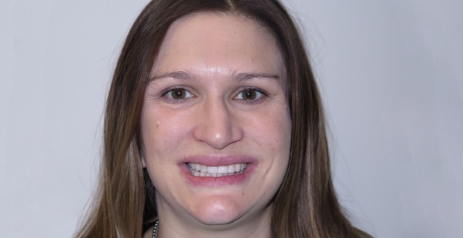 Woman grinning after Invisalign treatment