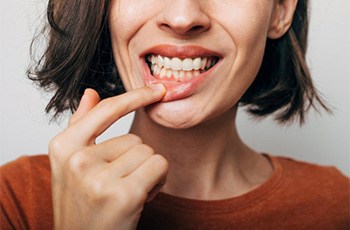 Woman pulling her lip back to reveal her gums