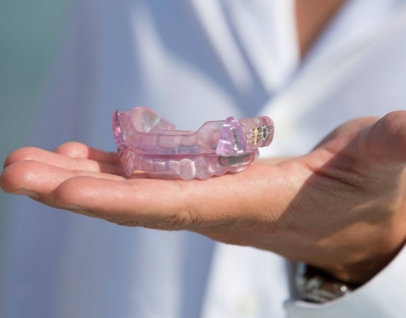 Dentist holding light purple occlusal splint trays