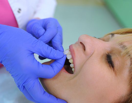 Woman getting veneers
